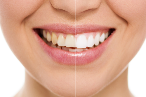 Cosmetică și estetică dentară