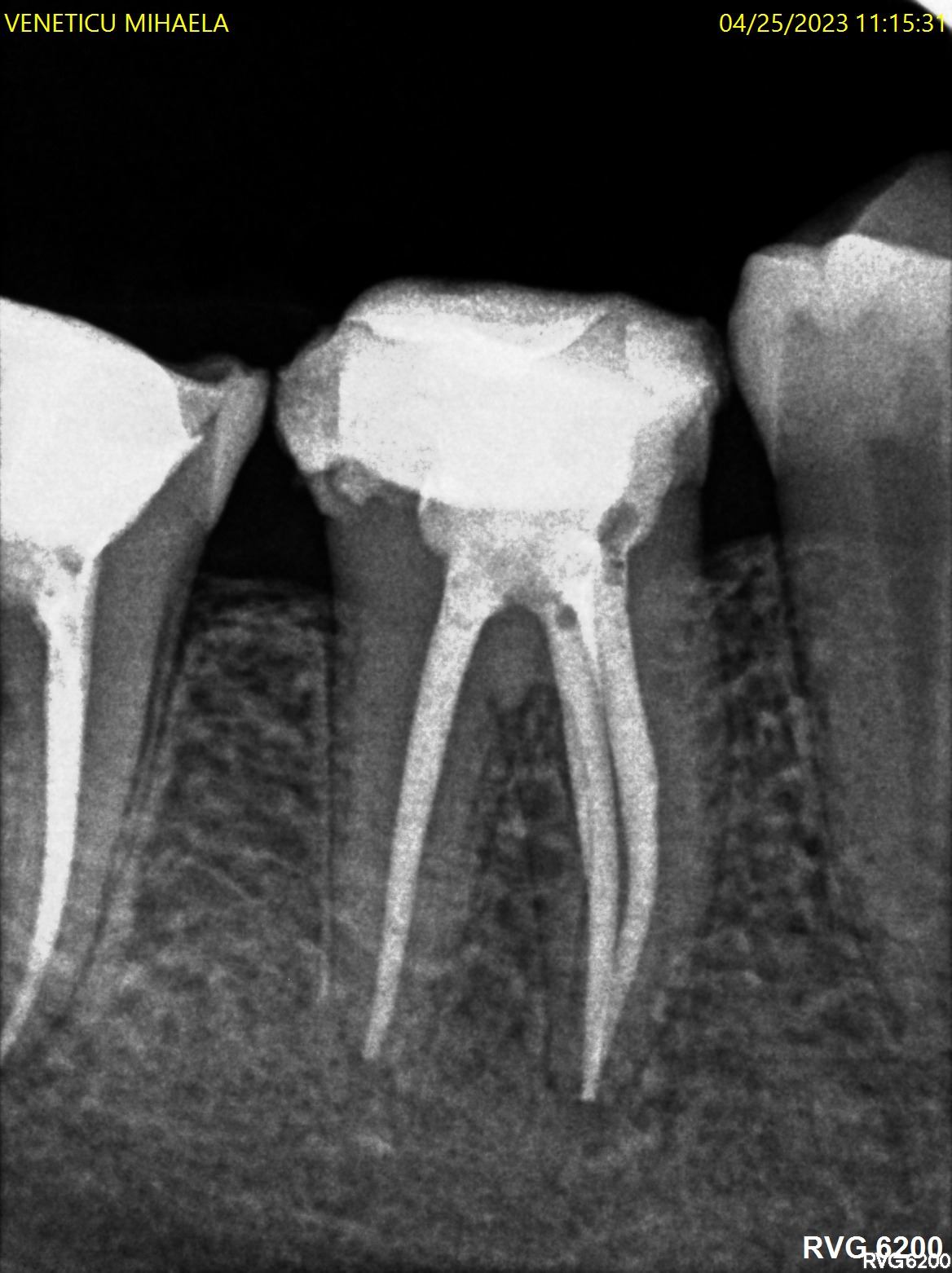 Endodonție